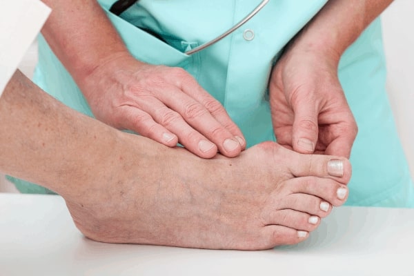 Consultant examining a patient's bunion